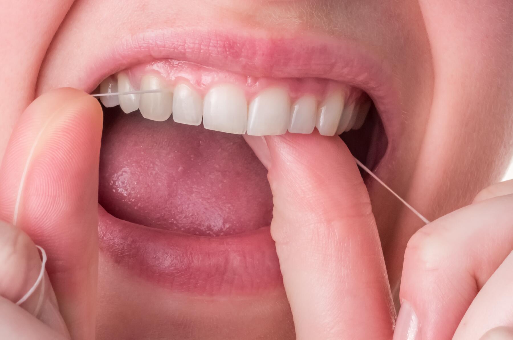 OC_ELGYDIUM CLINIC_Dental Floss_Application_Teeth_1_2019